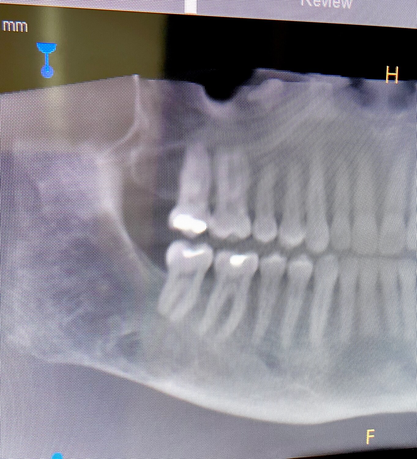 After his own surgery, Dr. Justin Neylund, DDS, with Black Diamond Dental, said he has learned how to manage temporomandibular joint pain for himself and his patients.