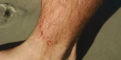 two-people-suffer-minor-shark-bites-in-new-smyrna-beach-wndb-news